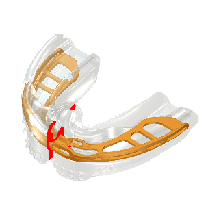 Myobrace® for Braces - B2