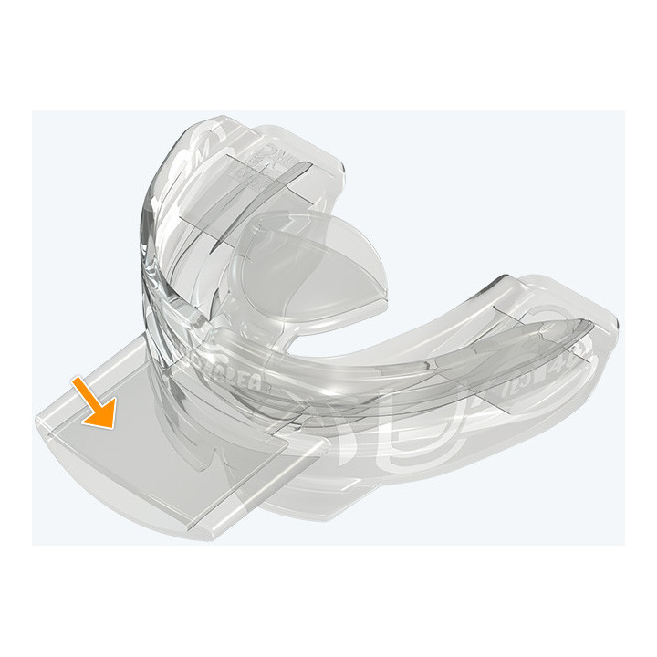 Myotalea® Tongue, Lip & Jaw Appliance for Braces - TLJB